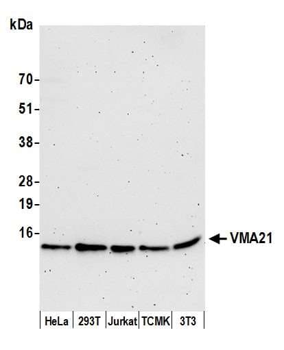 VMA21 / XMEA Antibody (aa1-50)
