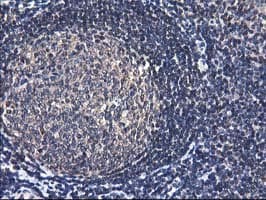 ALS2CR1 / NIF3L1 Antibody (clone OTI4B5)