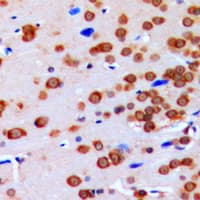 Polyclonal Rabbit anti-Human GBP3 Antibody (C-Terminus, IHC, WB)