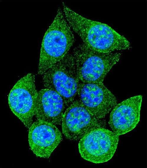 Polyclonal Rabbit anti-Human RAD9A / RAD9 Antibody (Ser387, IHC, IF, WB)
