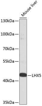 Polyclonal Rabbit anti-Human LHX5 Antibody (WB)
