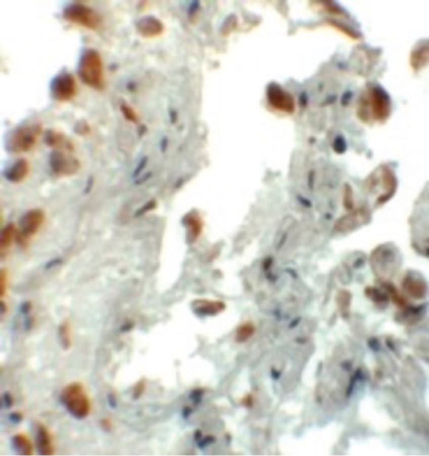 Polyclonal Rabbit anti-Human EZH1 / ENX-2 Antibody (IHC, IF, WB)