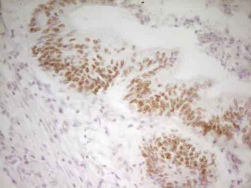 ATF1 Antibody (clone OTI5D10)