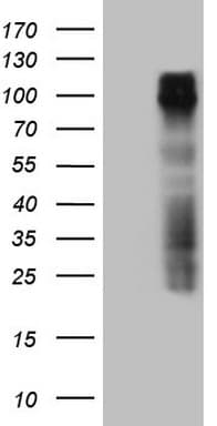 Monoclonal Mouse anti-Human GPNMB / Osteoactivin Antibody (clone OTI1E3, Carrier-free, WB)