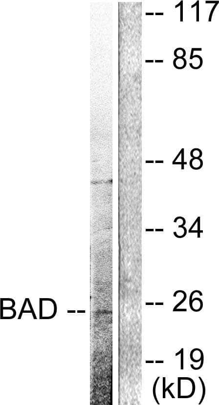 Polyclonal Rabbit anti-Mouse BAD Antibody (Cleaved-Asp71, IHC, WB)