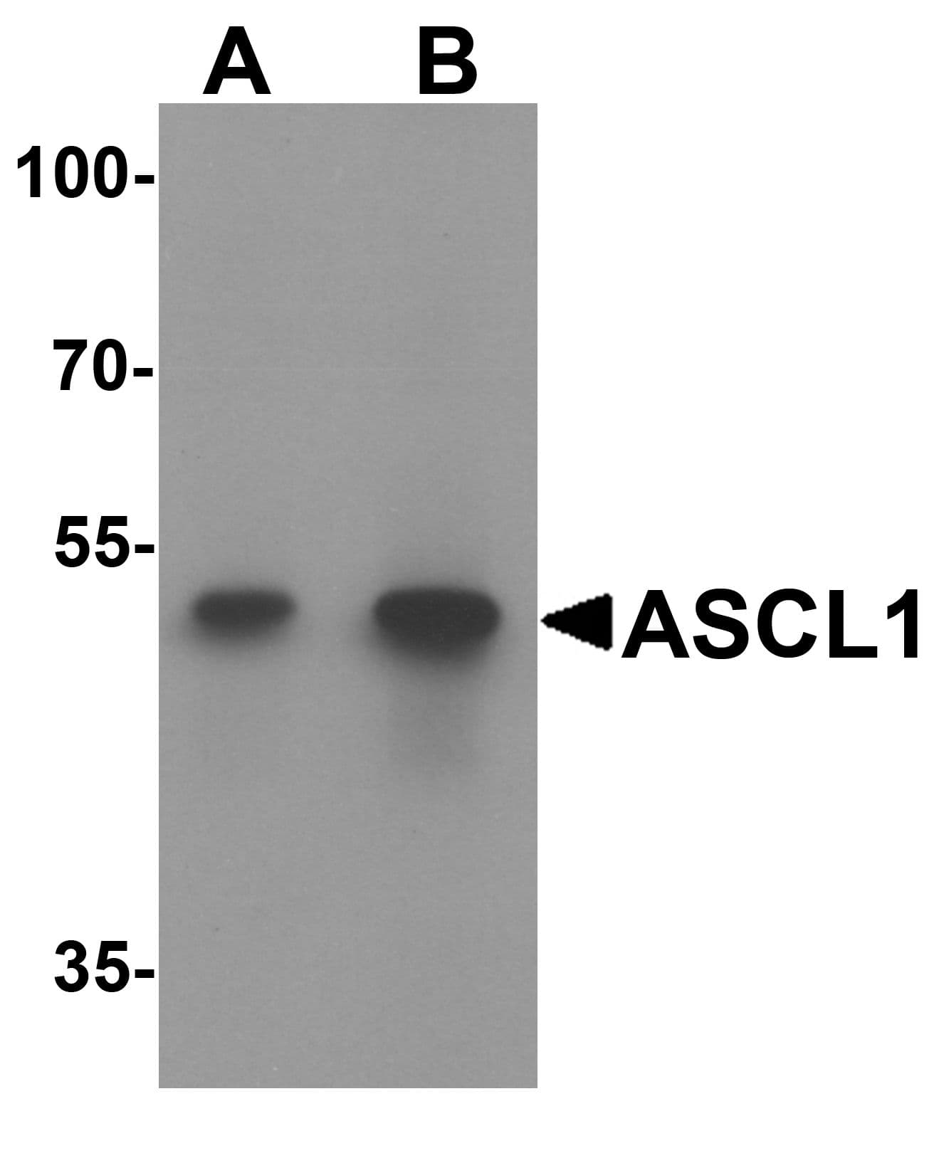 IHC-plus™ Polyclonal Rabbit anti-Human FACL2 / ACSL1 Antibody (IHC, IF, WB)