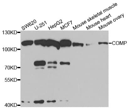 IHC-plus™ Polyclonal Rabbit anti-Human COMP / THBS5 Antibody (IHC, IF, WB)