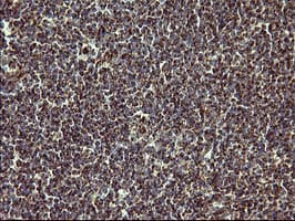 MMP13 Antibody (aa104-471, clone OTI2D8)