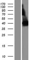 PDE4DIP / MMGL Protein (Over-Expression Lysate Myc-DDK (Flag))