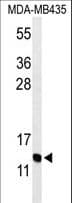 Polyclonal Rabbit anti-Human GNRH2 Antibody (aa26-53, WB)