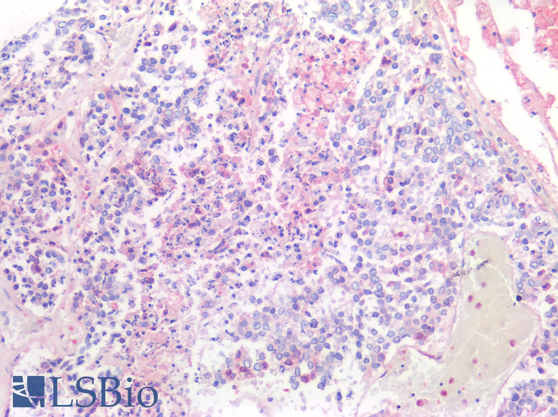 PathPlus™ Monoclonal Mouse anti-Human Alpha-Fetoprotein Antibody (clone AFP-11, Concentrated, IHC)