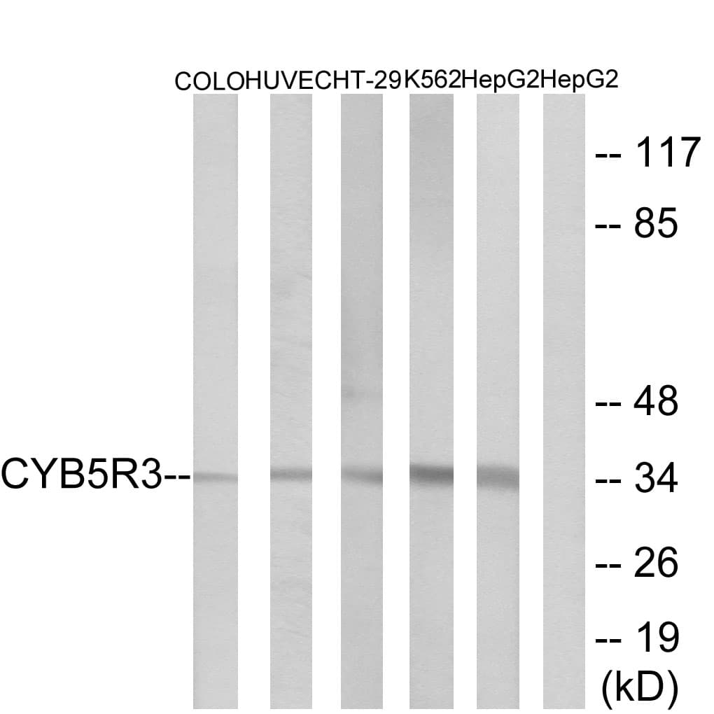CYB5R3 / B5R Antibody (aa137-186)