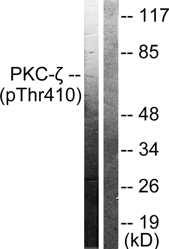 PRKCZ / PKC-Zeta Antibody (phospho-Thr410)