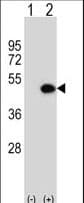 ILKAP Antibody (aa243-270)