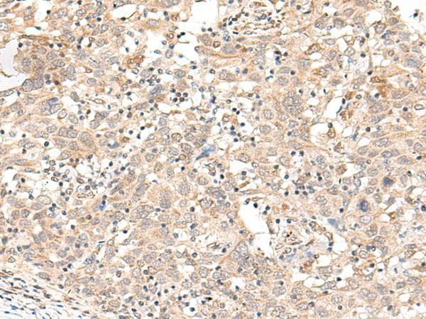 Polyclonal Rabbit anti-Human FUT3 Antibody (IHC)