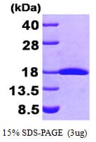 Human FHIT Protein (Recombinant His)
