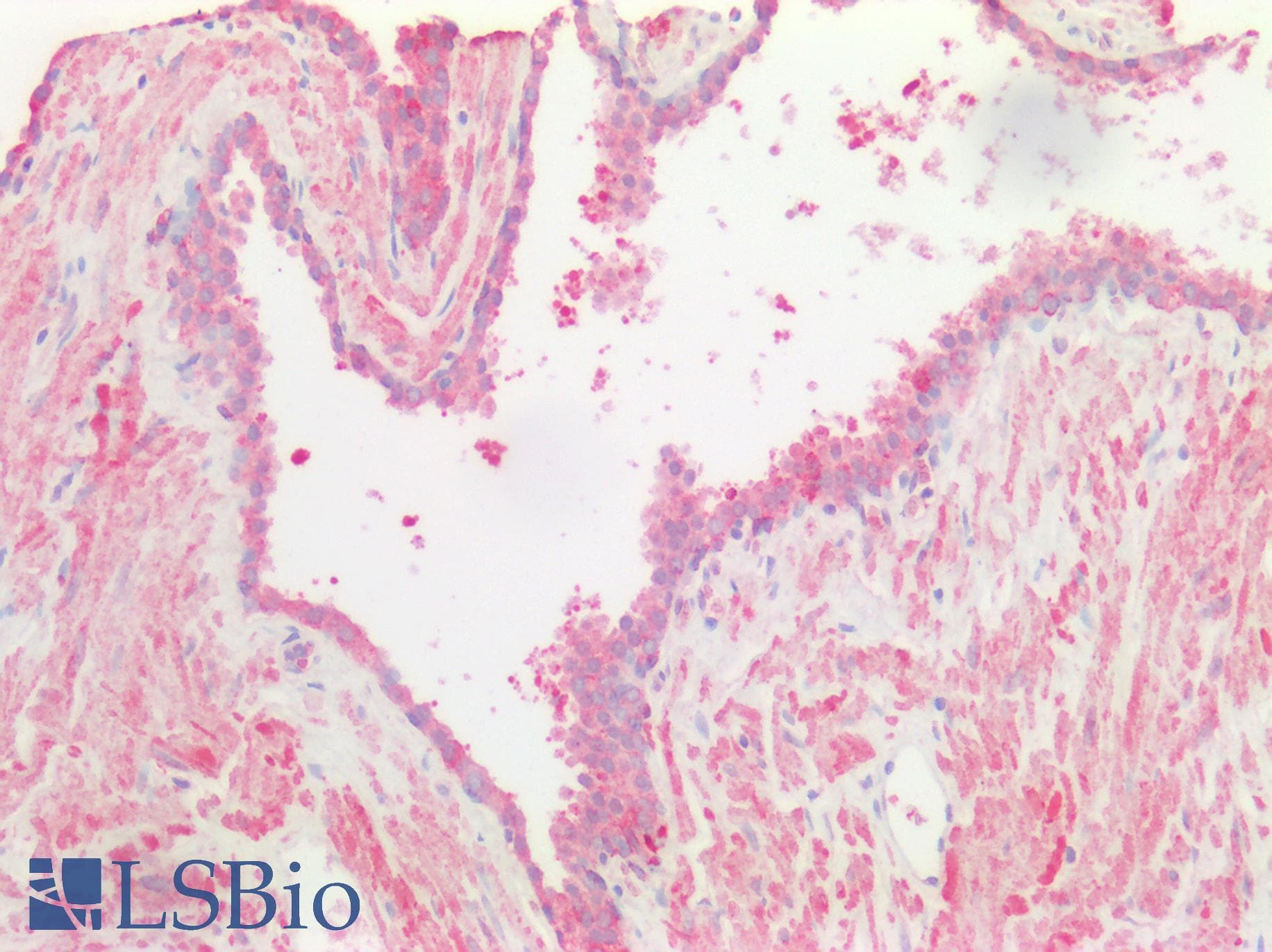 PathPlus™ KRT5 / CK5 / Cytokeratin 5 Antibody