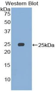 SMC3 / HCAP Antibody (aa994-1181)