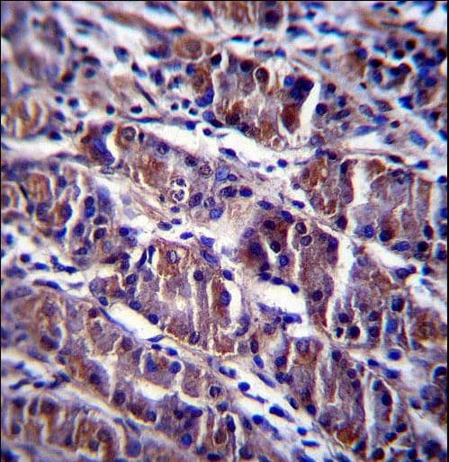 Polyclonal Rabbit anti-Human HDAC7 Antibody (aa846-875, IHC, WB)