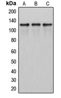 ITPKB Antibody (Internal)