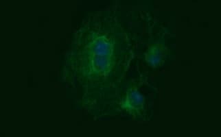 TUBB2B / Tubulin Beta 2B Antibody (clone OTI0C3)