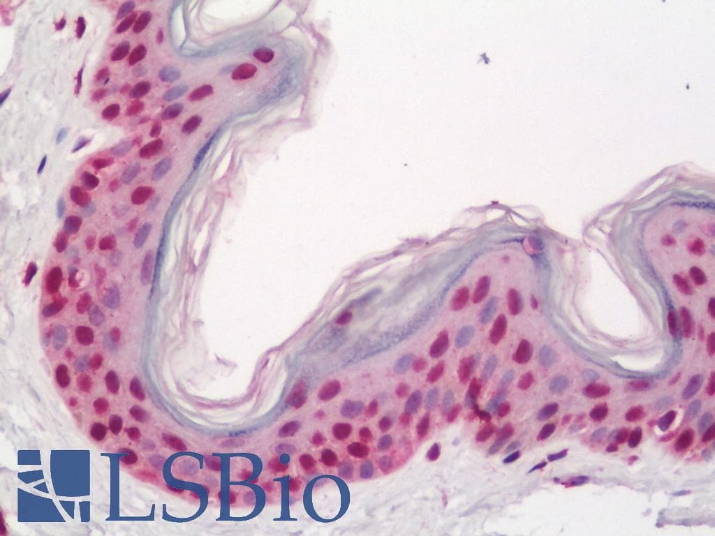 IHC-plus™ TOP1 / Topoisomerase I Antibody (aa715-765)