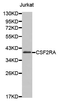 CSF2RA / CD116 Antibody
