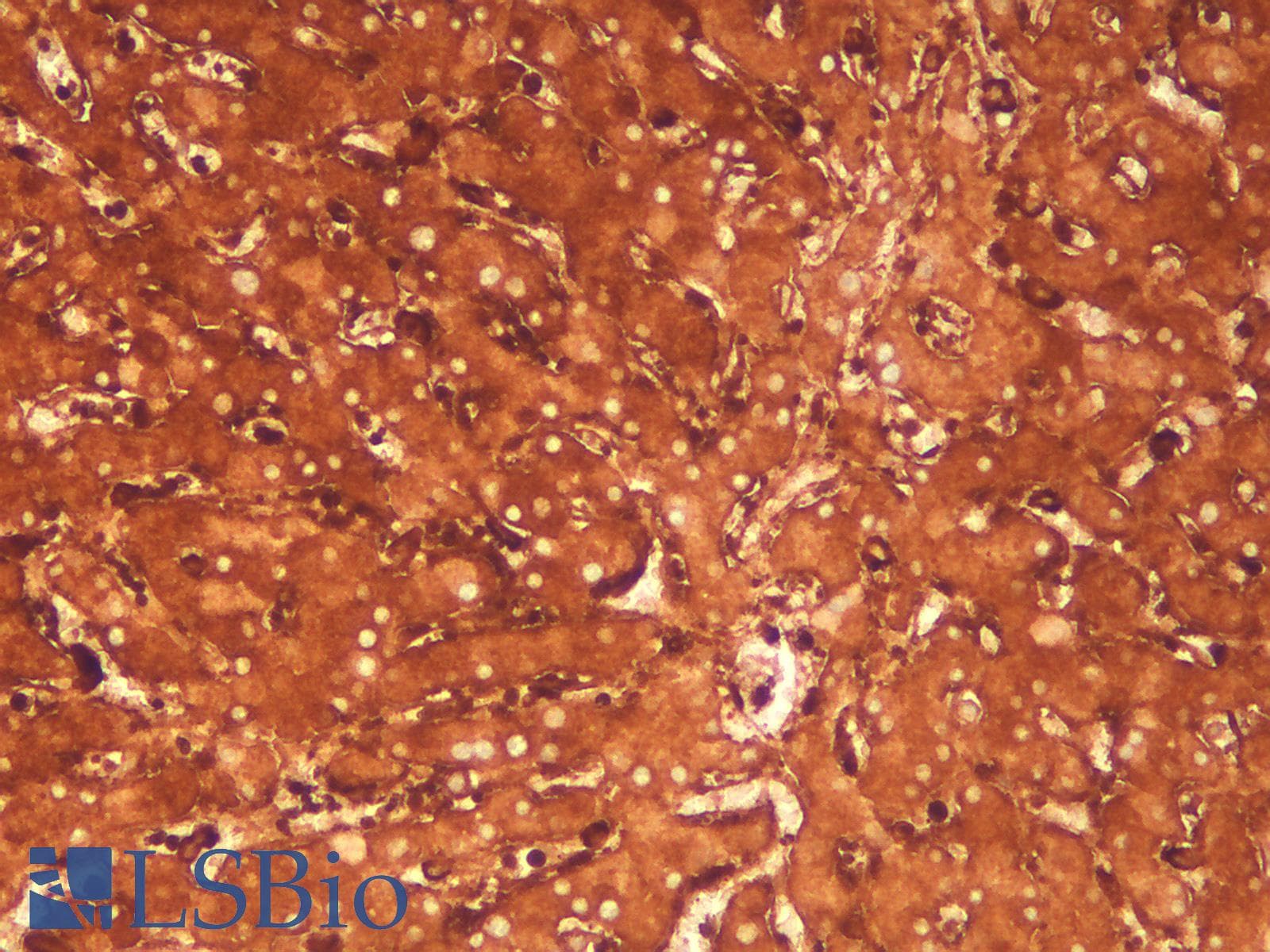 PathPlus™ Recombinant Monoclonal Rabbit anti-Human FTL / Ferritin Light Chain Antibody (clone FTL/2338R, aa 38-165, IHC, WB)