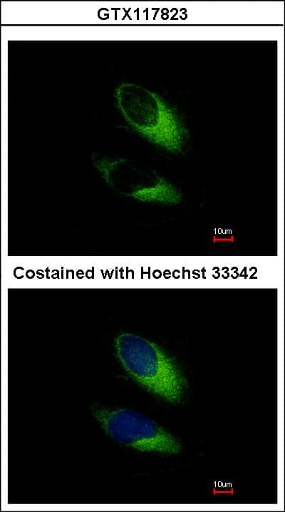SNAP23 / SNAP-23 Antibody