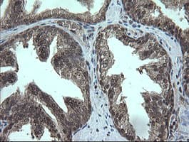 TRMT2A Antibody (clone OTI3B3)