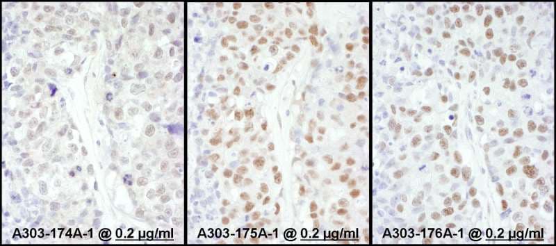 HSF1 Antibody (aa425-475)