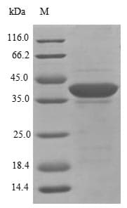 Rat EIF3I / EIF3S2 Protein (Recombinant 6His, N-terminus)