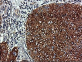 Monoclonal Mouse anti-Human FDFT1 / Squalene Synthase Antibody (clone OTI2F10, IHC, IF, WB)