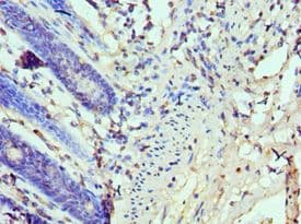 TP53BP1 / 53BP1 Antibody (aa1758-1972)