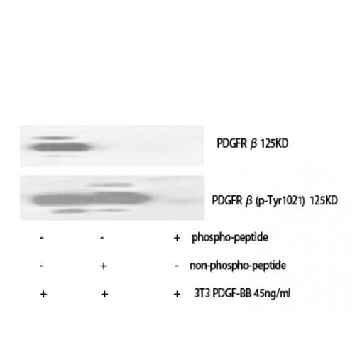 Polyclonal Rabbit anti-Human PDGFRB / PDGFR Beta Antibody (960-1040 aa, IHC, WB)