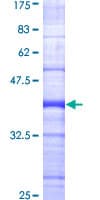 Human BIK Protein (Recombinant GST, N-terminus)