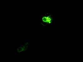 Prominin 2 / PROM2 Antibody (clone OTI13A9)