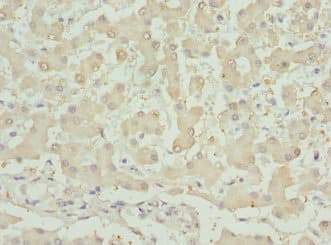 Polyclonal Rabbit anti-Human INHBB / Inhibin Beta B Antibody (WB)