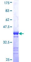 Human GSC / Goosecoid Protein (Recombinant GST, N-terminus)