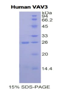 Human VAV3 Protein (Recombinant His)