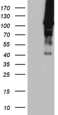 HACE1 Antibody (clone OTI4E10)