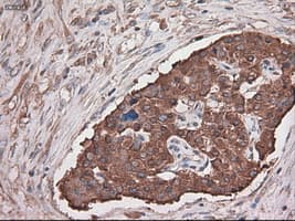 Monoclonal Mouse anti-Human CPA1 / Carboxypeptidase A Antibody (clone OTI2A3, IHC, IF, WB)