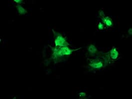 HCA557B / METTL21A Antibody (clone OTI2D3)