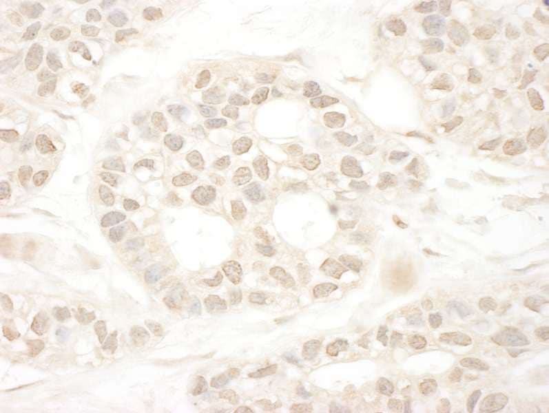 ARA70 / NCOA4 Antibody (aa500-550)