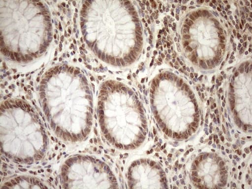 MGMT Antibody (clone OTI10H9)