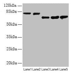 APP / Beta Amyloid Precursor Antibody (aa18-249)