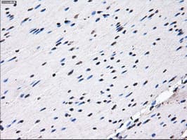 RPA2 / RFA2 / RPA34 Antibody (clone OTI1H10)