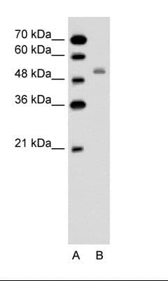 SLC12A1 / NKCC2 Antibody (aa351-400)