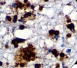 Toxoplasma gondii Antibody