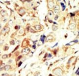 IGF1R / IGF1 Receptor Antibody (aa19-51)